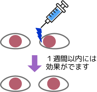 ボツリヌス治療